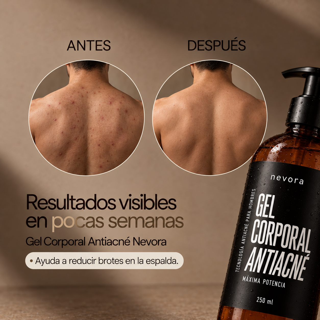 Gel corporal antiacné Nevora